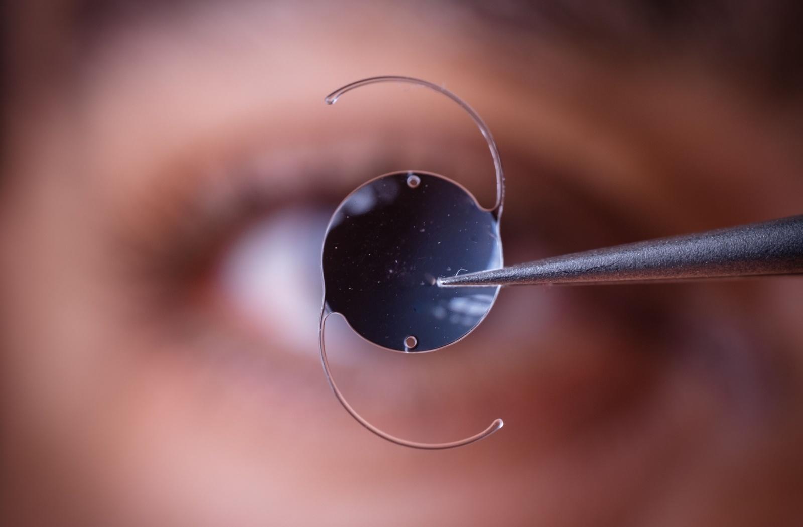 A close up of a cataract lens replacement, known as an intraocular lens (IOL).
